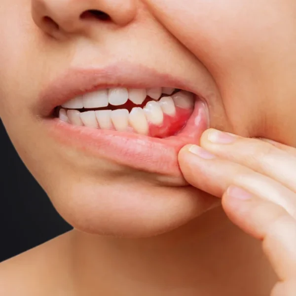 Periodontoloji